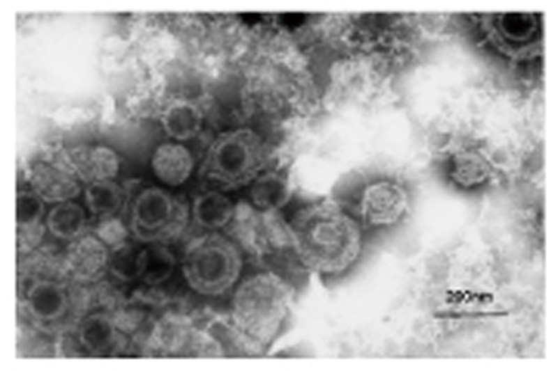水痘・帯状疱疹ウイルス（電子顕微鏡で撮影）