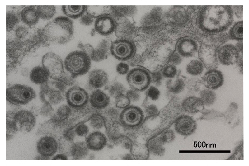 水痘・帯状疱疹ウイルス（電子顕微鏡で撮影）